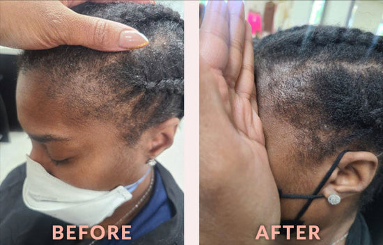 Design Essentials Scalp Care Edge & Temple Strengthening Oil, 4 oz